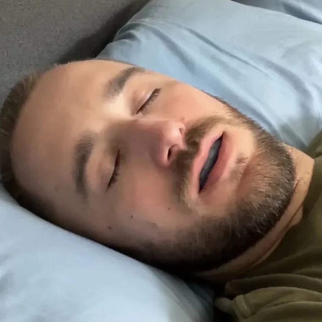 BodyShaker - Universell tyst anti-snarkningsskena