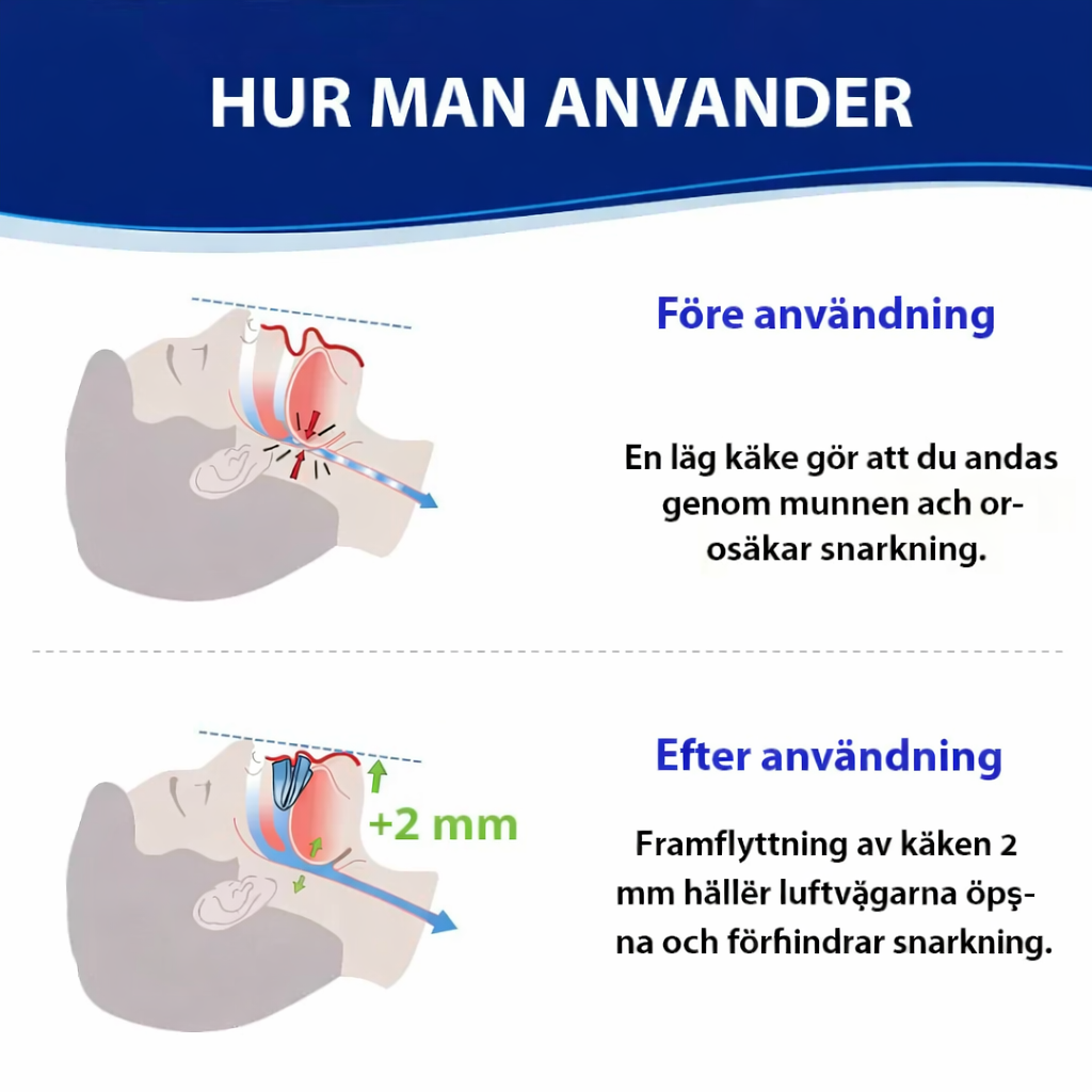 BodyShaker - Universell tyst anti-snarkningsskena