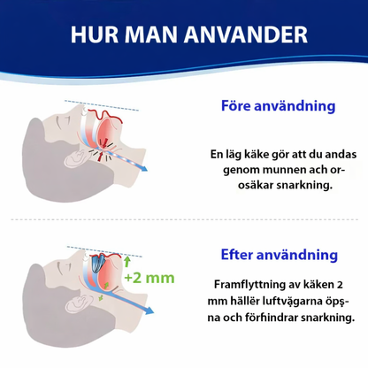 BodyShaker - Universell tyst anti-snarkningsskena